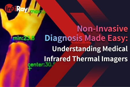Nem invazív diagnózis könnyű: megértése orvosi infravörös hőképező